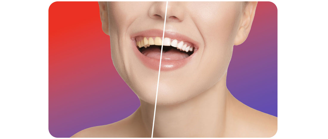 Blog : Hydropulseur dentaire tartre - oralirrigator.fr