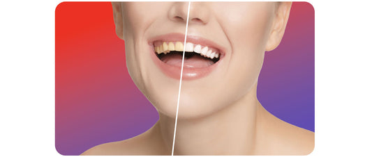 Blog : Hydropulseur dentaire tartre - oralirrigator.fr