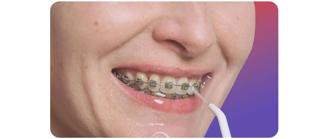 Blog : hygiène dentaire hydropulseur - oralirrigator.fr