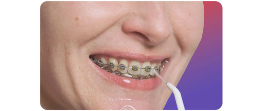 Blog : hygiène dentaire hydropulseur - oralirrigator.fr