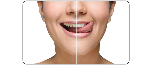 Blog : Jet dentaire pour enlever le tartre - oralirrigator.fr